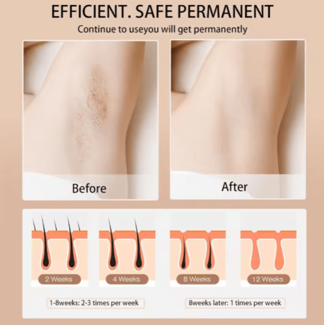 Babyverse - Digital IPL Hair Removal Device ©